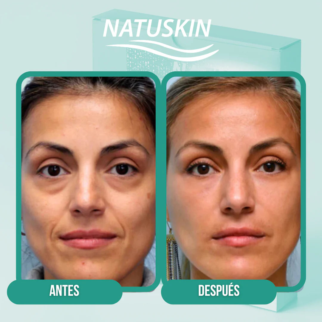 🔥 Lleva 12 parches paga 6 SOLO por HOY – Collagen Glow™ | Parches Colágeno Ojeras