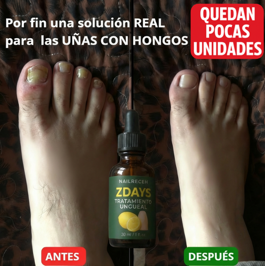 🔥 ÚLTIMAS unidades disponibles | NailRegen™: Resultados visibles en 7 días